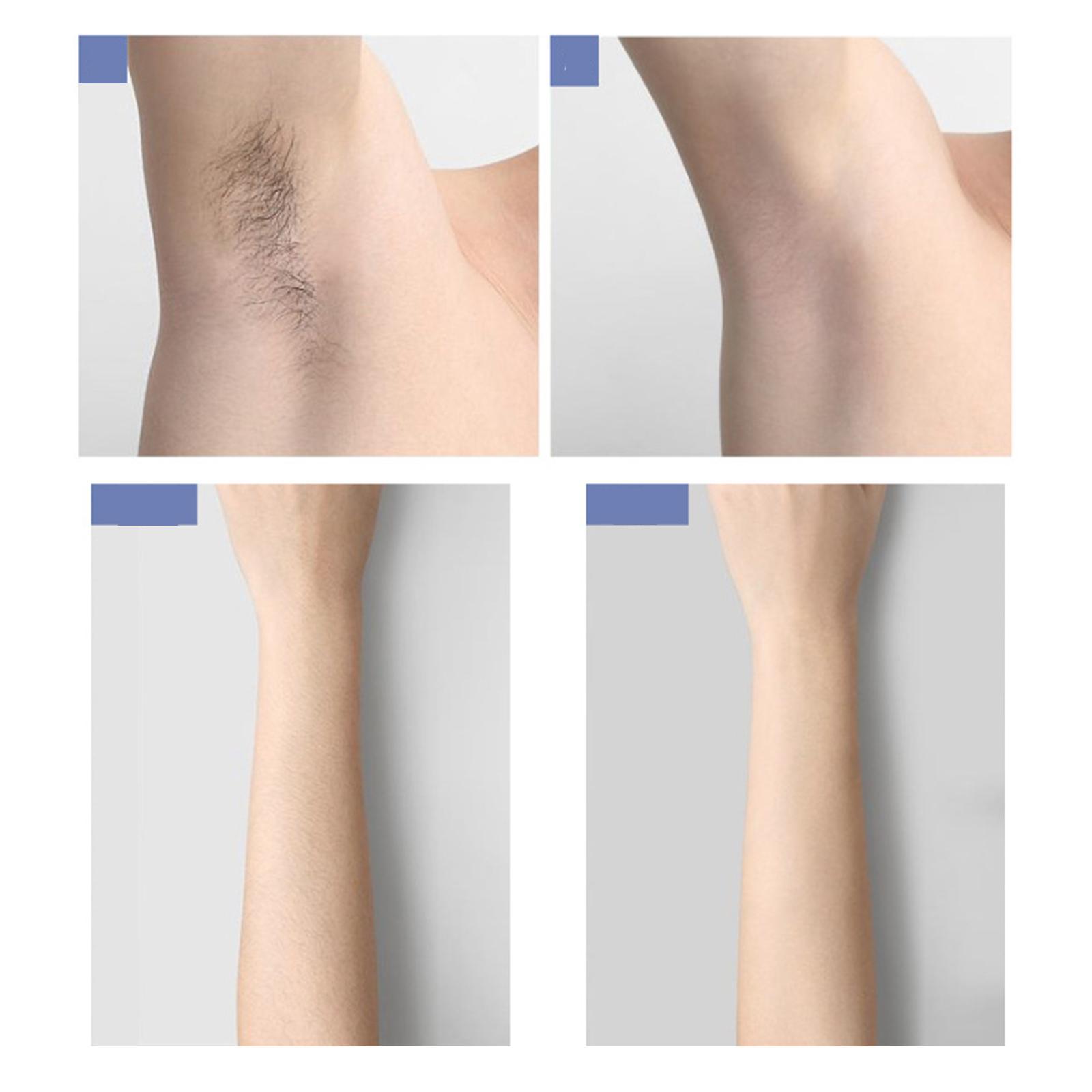 Painless Flashes Ice Cooling Hair Removal Machine for Men Women
