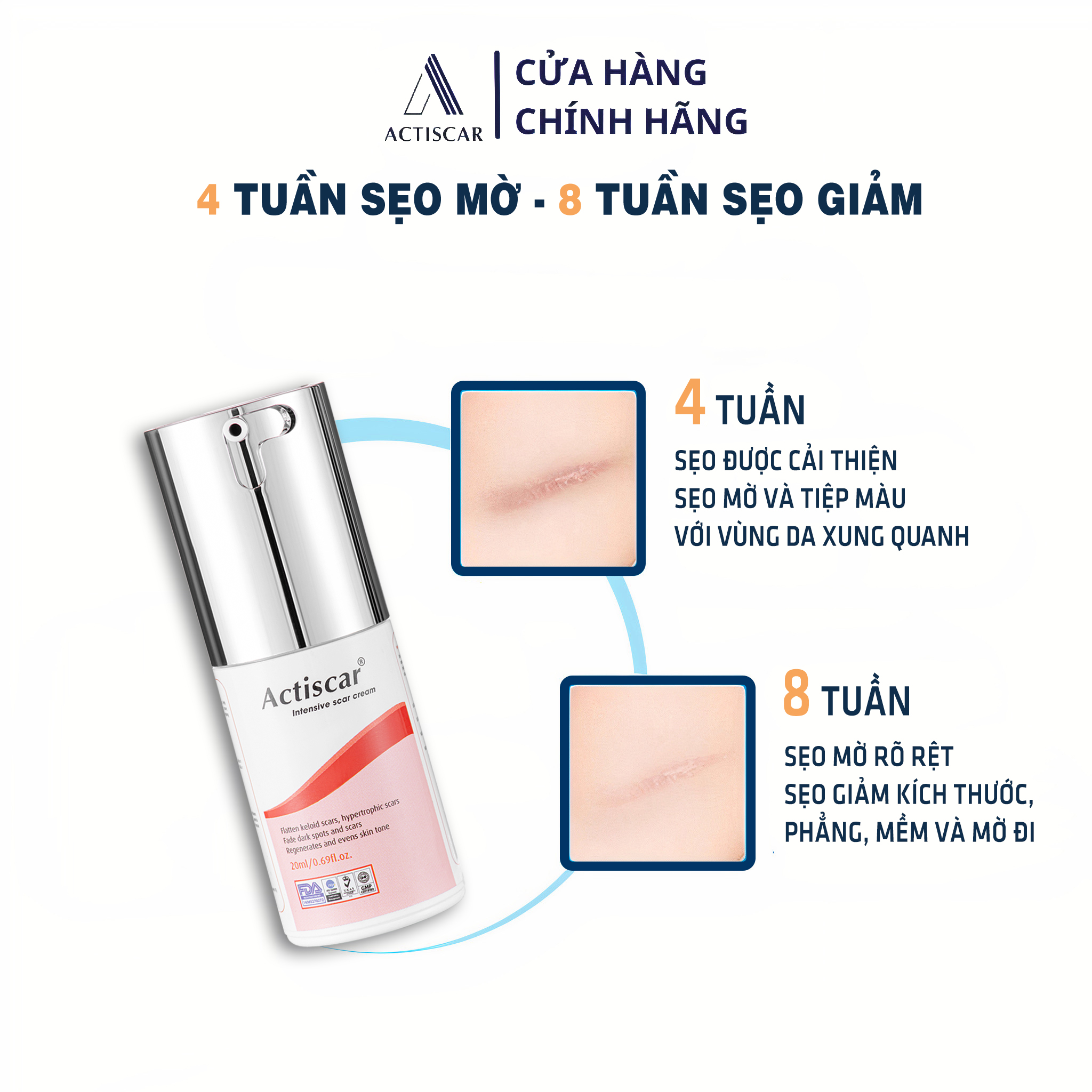 Kem Xóa Sẹo Lồi, Sẹo Phì Đại Actiscar ( Màu đỏ )