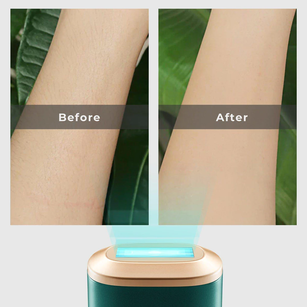 Máy Triệt Lông Lạnh Sapphire Air IPL ULIKE Hàn Quốc Hair Removal Device DEEP GREEN