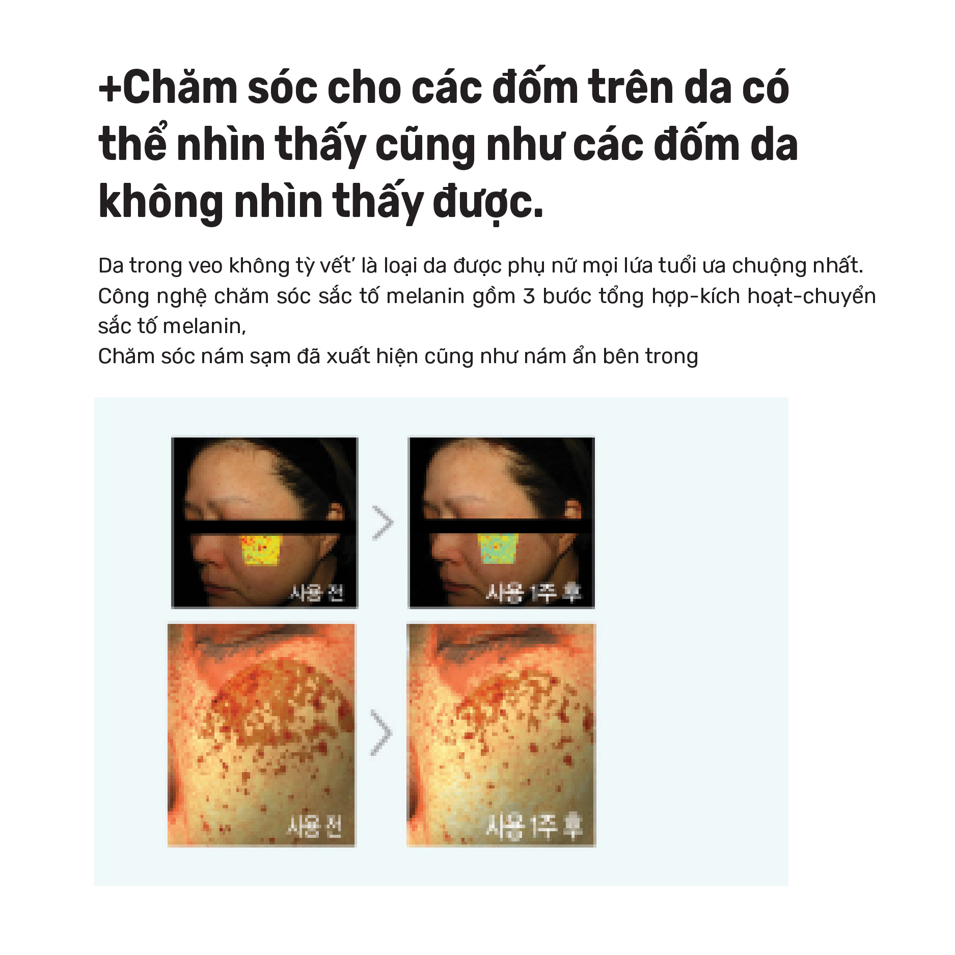 Combo TG Dominas Kem Dream Plus & Serum Dominas Dark Spot Treatment