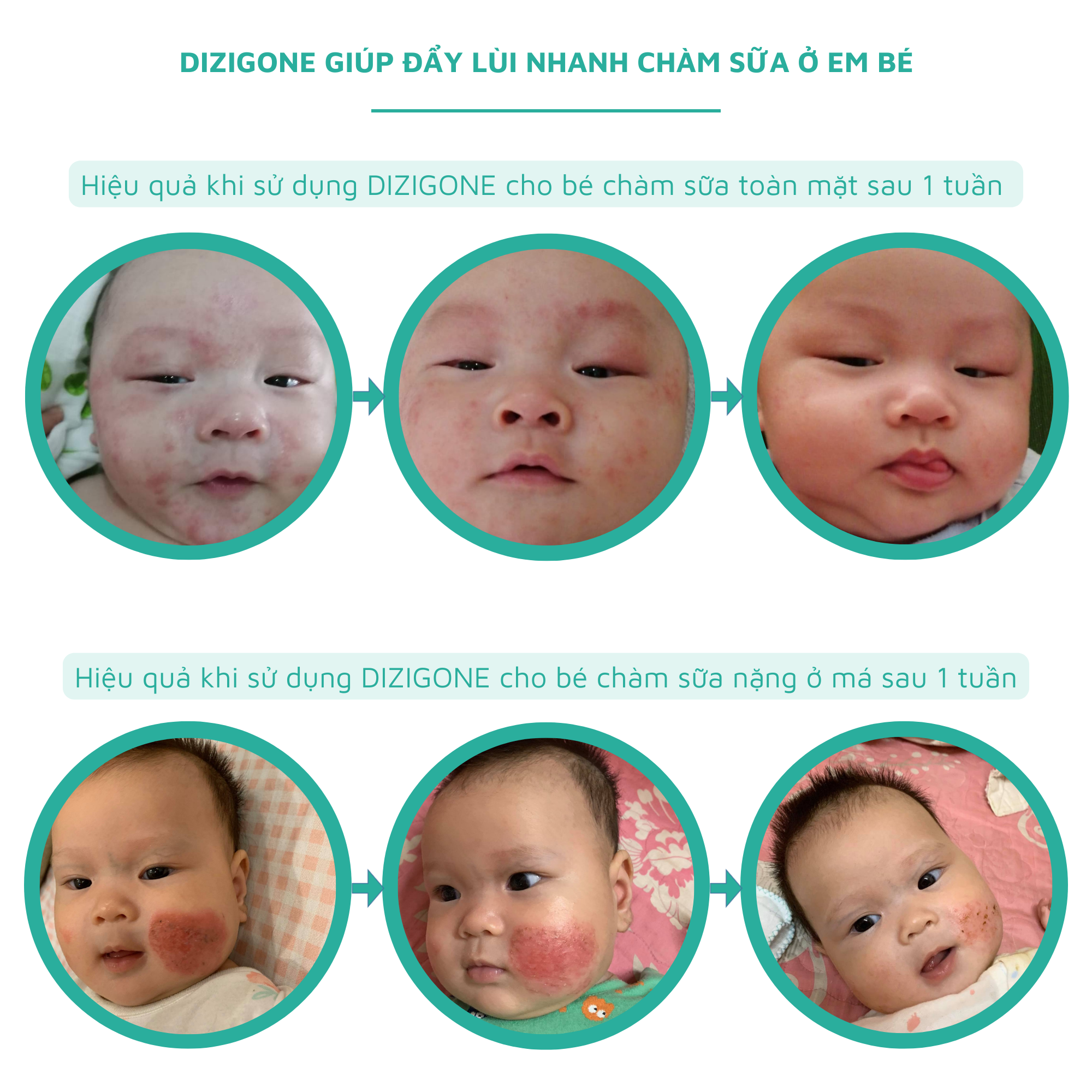 Kem bôi dịu da bé DIZIGONE Baby 30g