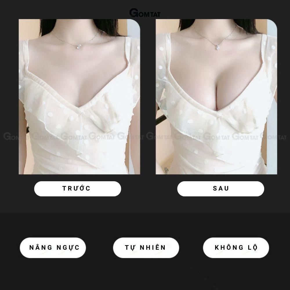Dán ngực cài trước mẫu quả xoài, tạo khe đẩy ngực bám dính tốt - SA-0011