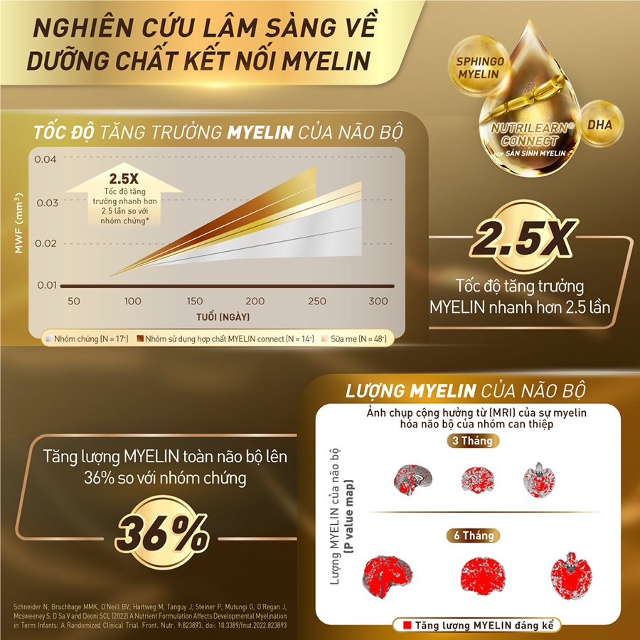 Sữa bột công thức S-26 ULTIMA 3 750G với hợp chất NUTRILEARN CONNECT giúp tăng tốc độ kết nối não bộ cho bé từ 2 - 6 tuổi - Tặng Bộ vali xúc cát