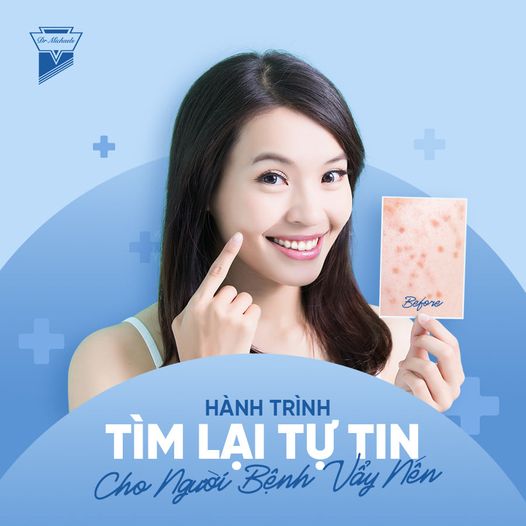 Bộ sản phẩm dành cho da Vẩy nến nhẹ Dr Michaels Soratinex lớn