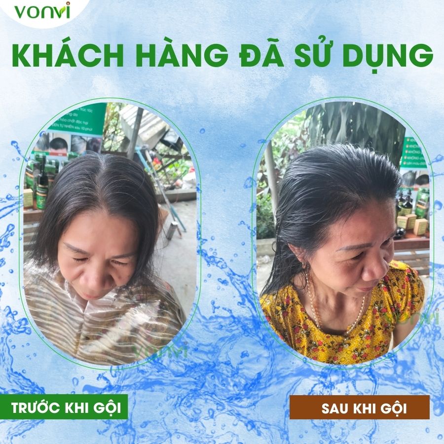 Thuốc nhuộm tóc VONVI làm đen tóc tự nhiên sau 10 phút với thiết kế dạng chai ấn 200 ml