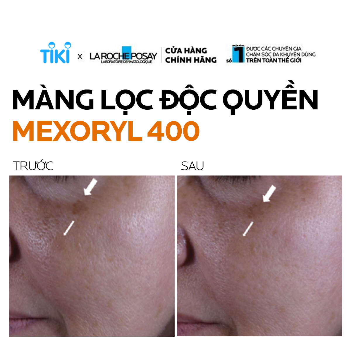 Kem Chống Nắng Không Màu Kiểm Soát Dầu La Roche-Posay Anthelios XL Dry Touch Gel-Cream SPF 50+ UVB & UVA