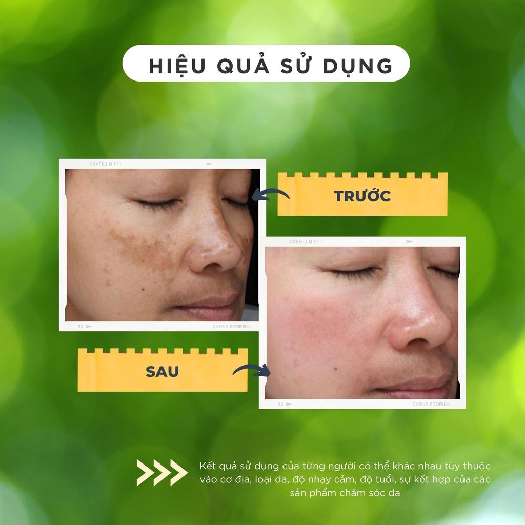 Combo Kem dưỡng và Serum dưỡng trắng và tái tạo da CHAMIS