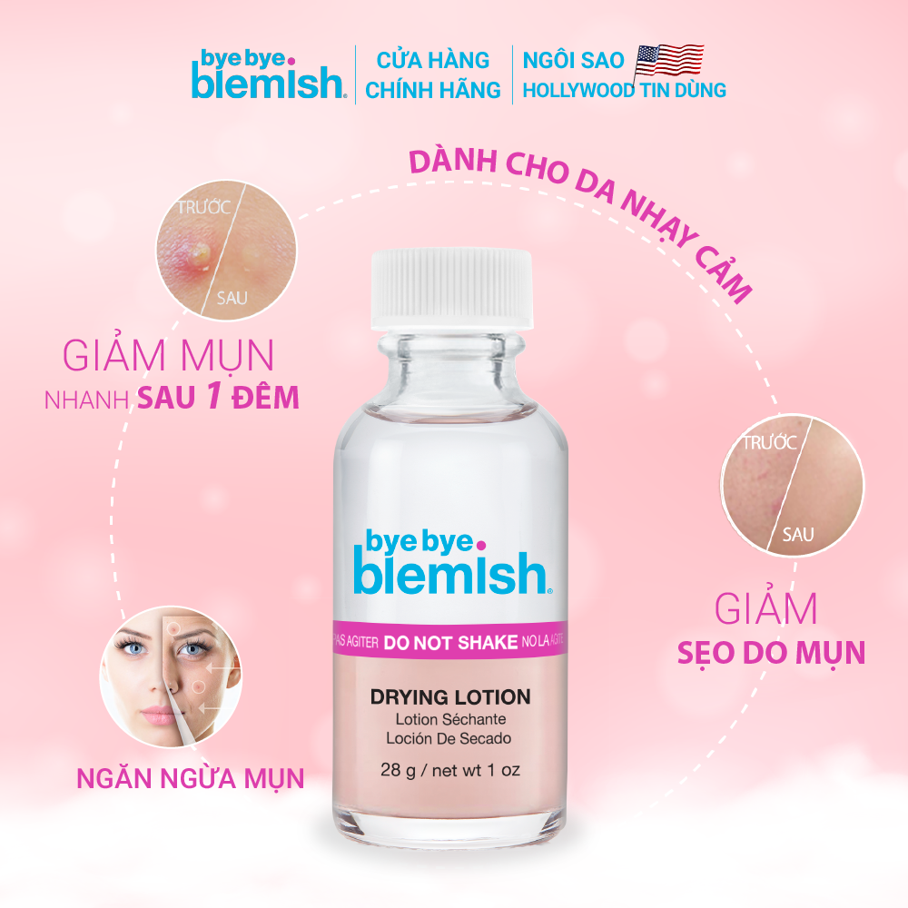 Chấm Mụn Giảm Mụn Nhanh Sau 1 Đêm Dành Cho Mụn Trắng, Sưng Đỏ Bye Bye Blemish Original Drying Lotion 30ml