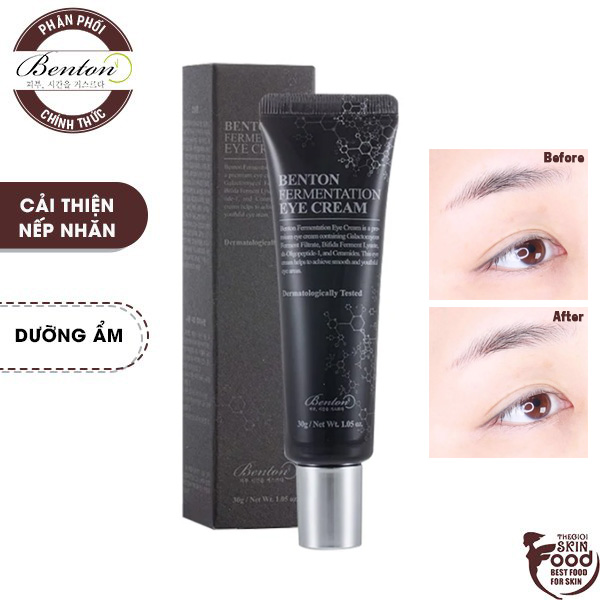 Kem Dưỡng Mắt Chống Lão Hóa Benton Fermentation Eye Cream 30g