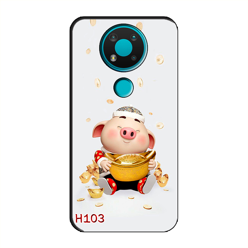 Ốp Dẻo Dành Cho NOKIA 3.4