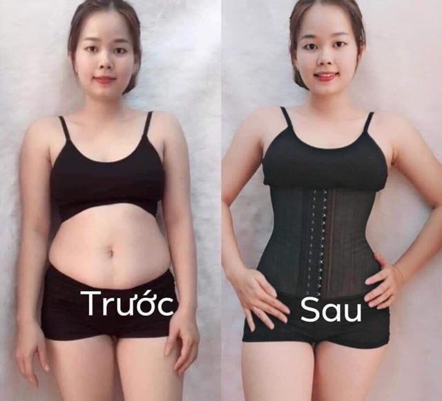 Đai nịt bụng Latex 25 xương