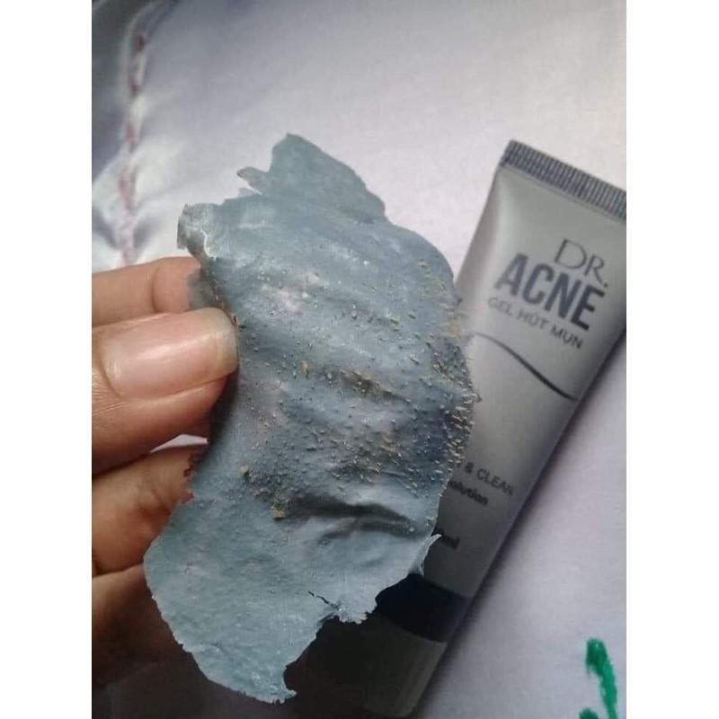 10 tuyp lột mụn ance