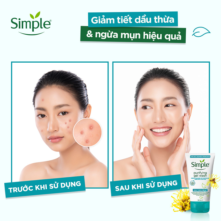 Combo 2 Sữa rửa mặt Simple giúp kiềm dầu và ngừa mụn hiệu quả - cho da mụn nhạy cảm 150ml