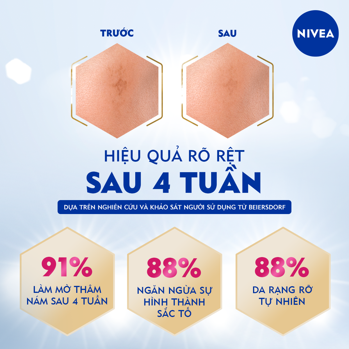 Tinh Chất Chuyên Sâu NIVEA LUMINOUS 630 Giúp Làm Mờ Đốm Nâu | Ngăn Ngừa Thâm Nám - 86580
