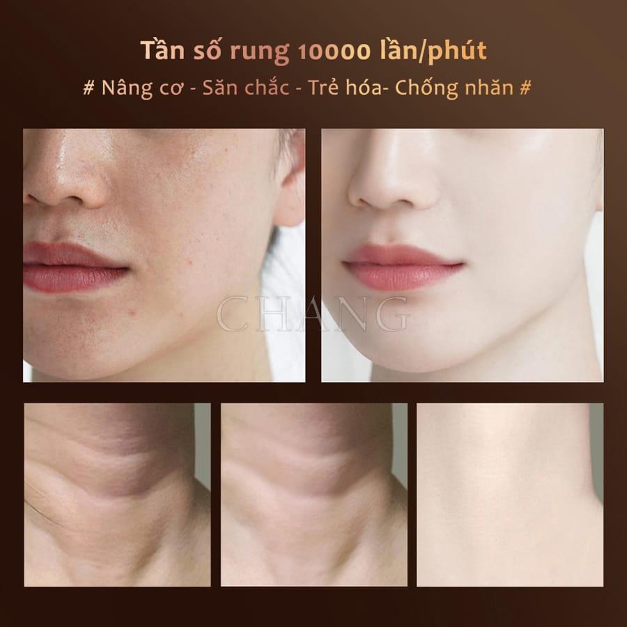 Máy Massage Nâng Cơ Mặt, Máy Đẩy Tinh Chất Cho Cổ Và Mặt Làm Thon Gọn Mặt, Xóa Mờ Nếp Nhăn, Trẻ Hóa Làn Da Hiệu Quả