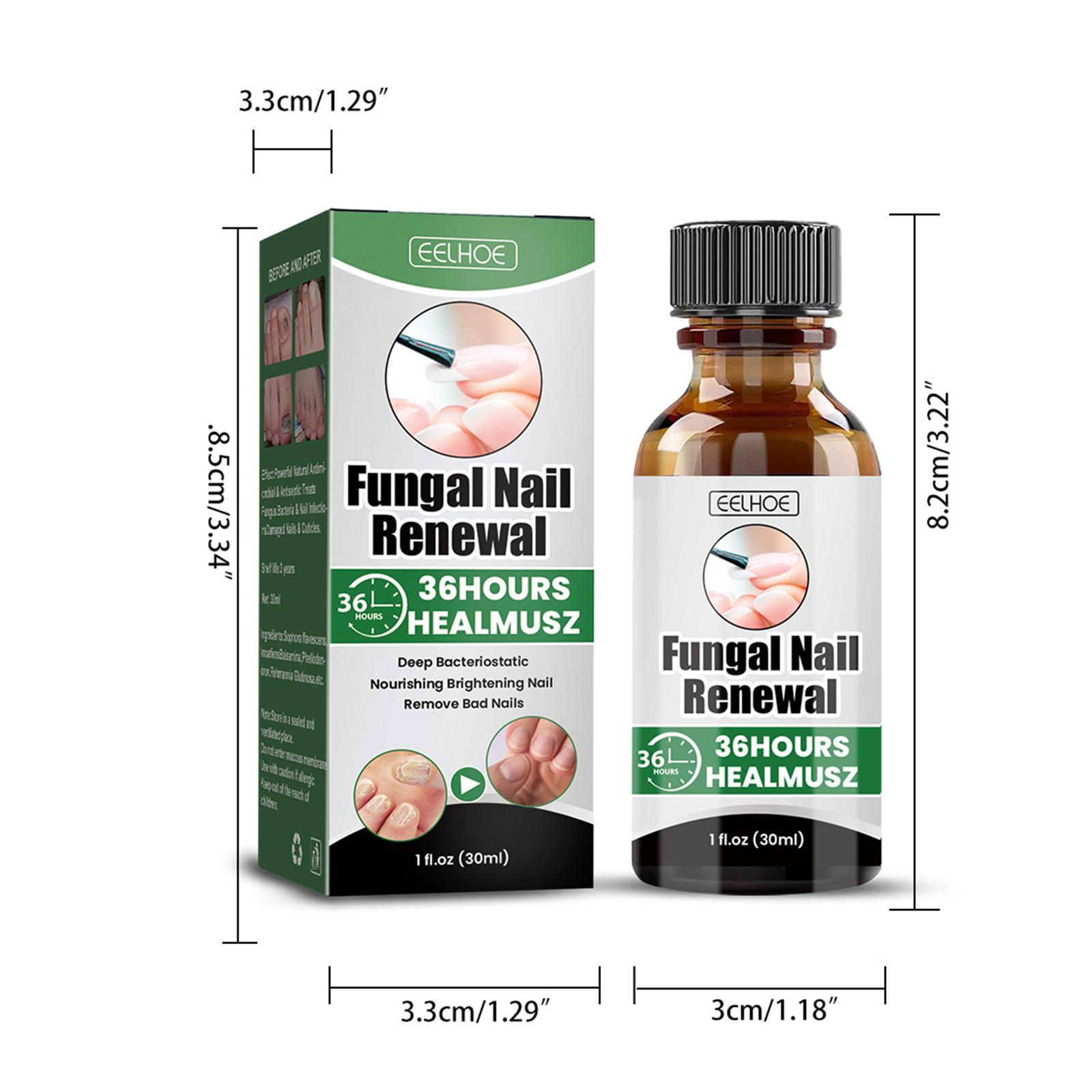 EELHOE 30ml Nail Treatment Essence for Onychomycosis Mild Non-irritating Nail Bright Shiny Repair Nail Repair Solution