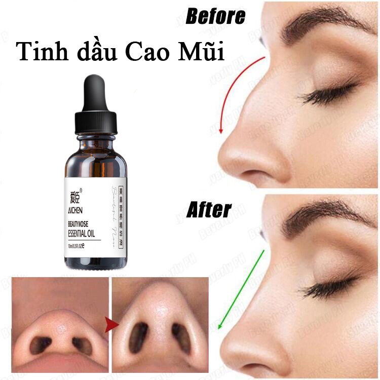 Tinh dầu nâng mũi tạo hình xương mũi hoàn toàn tự nhiên nâng sống mũi tinh chất 10ml sửa mũi làm thẳng mũi có hiệu quả