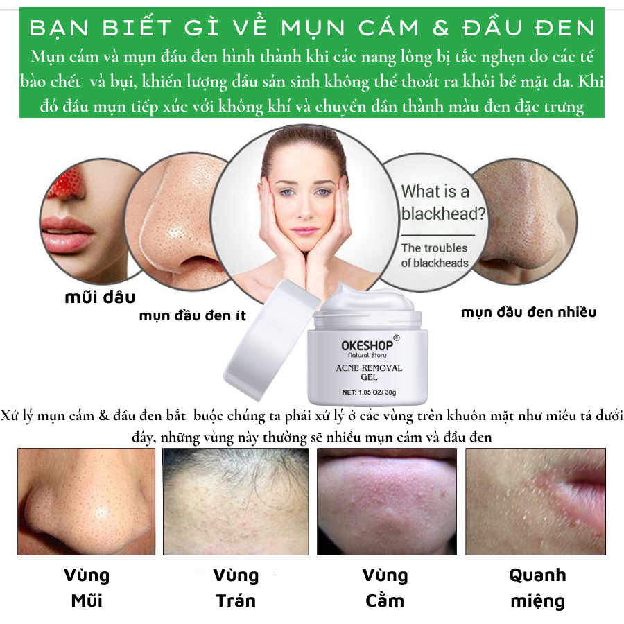 Gel Lột Mụn Nha Đam OKESHOP 30ml - Giải Pháp Loại Bỏ Mụn Đầu Đen - Mụn Cám - Bạ Nhờn - Làm Sạch Sâu Và Thu Nhỏ Lỗ Chân Lông