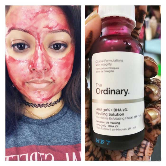 Serum Tẩy tế bào chết, cải thiện mụn, vết thâm tái tạo da The Ordinary AHA 30% BHA 2% Peeling Solution