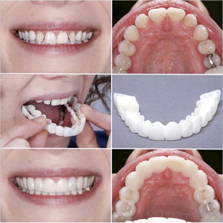 Set 2 hàm răng giả bằng silicon Tự Nhiên Tiện Dụng che khoảng trống răng thưa