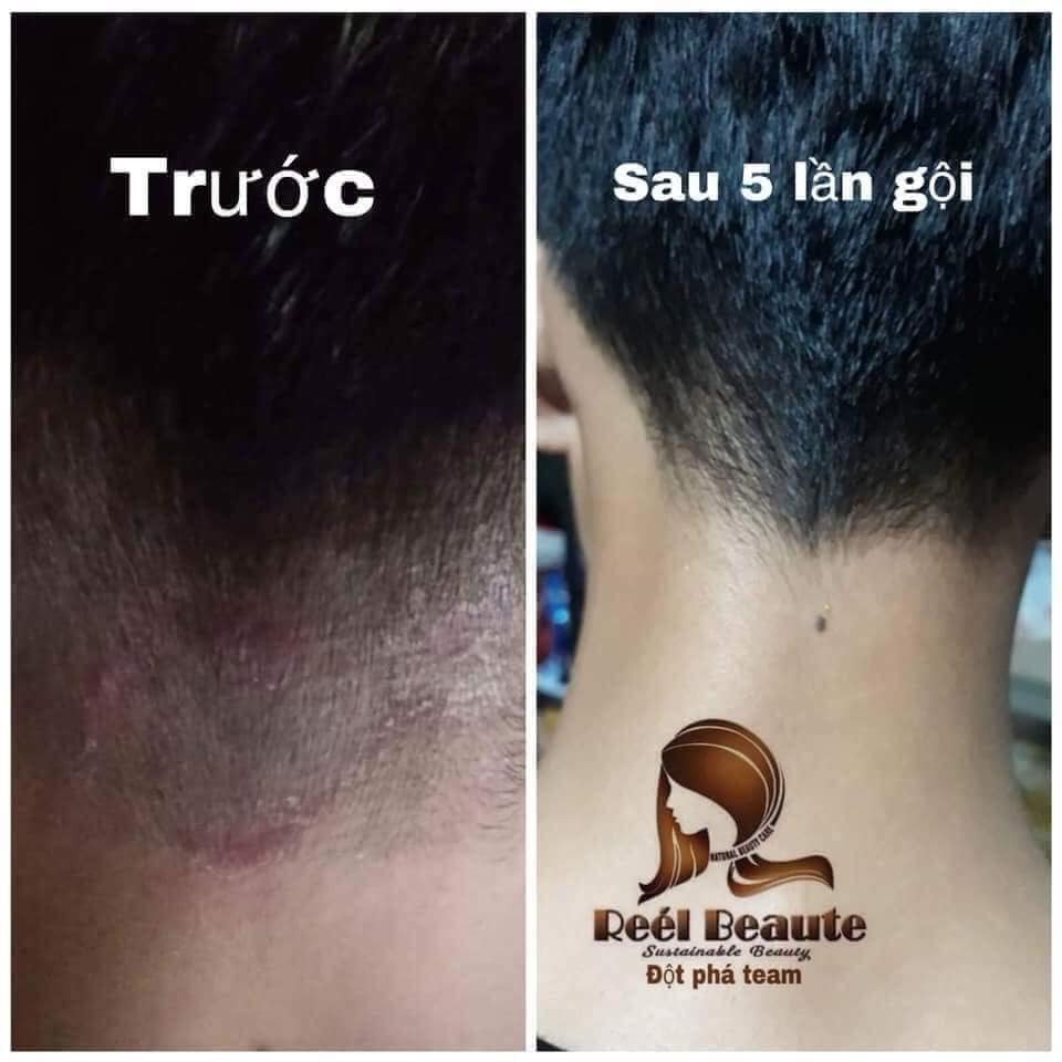 TÚI LỌC GỘI ĐẦU THIÊN NHIÊN REE'L BEAUTE - DÒNG CAO CẤP