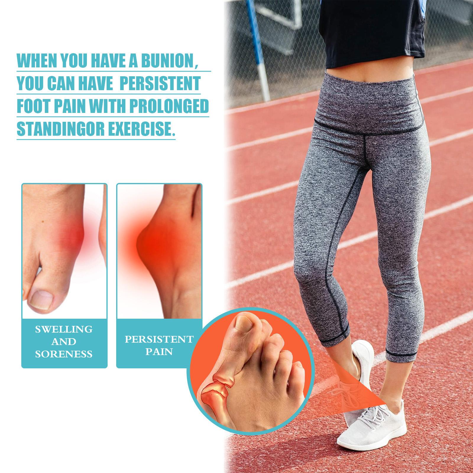 South Moon 8PCS Bunion Patch Relief Bunion Swelling Pain Patch Correction Foot Care Patch