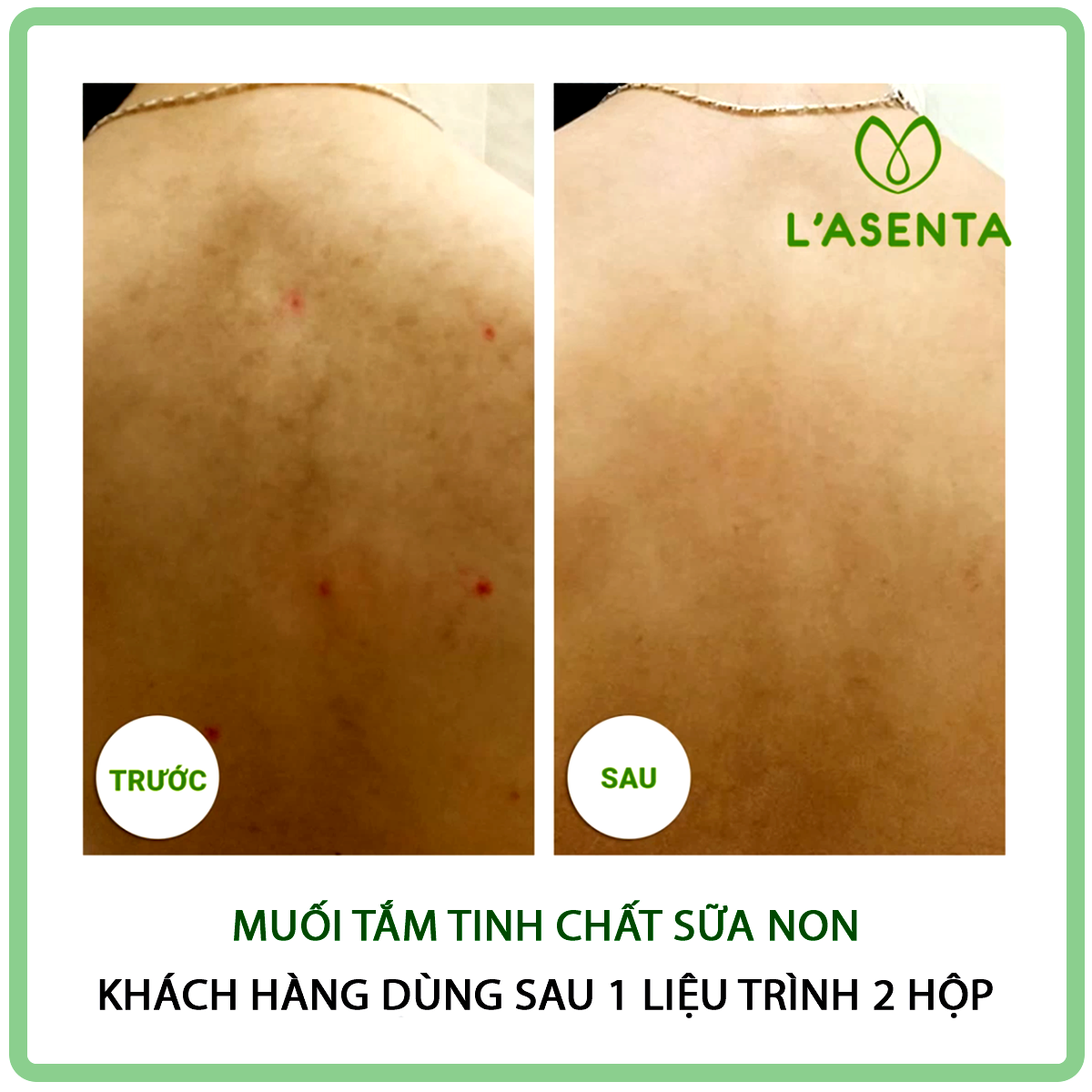 Muối Tắm Tinh Chất Sữa Non L’asenta  Colostrum Salt Scrub (200g)