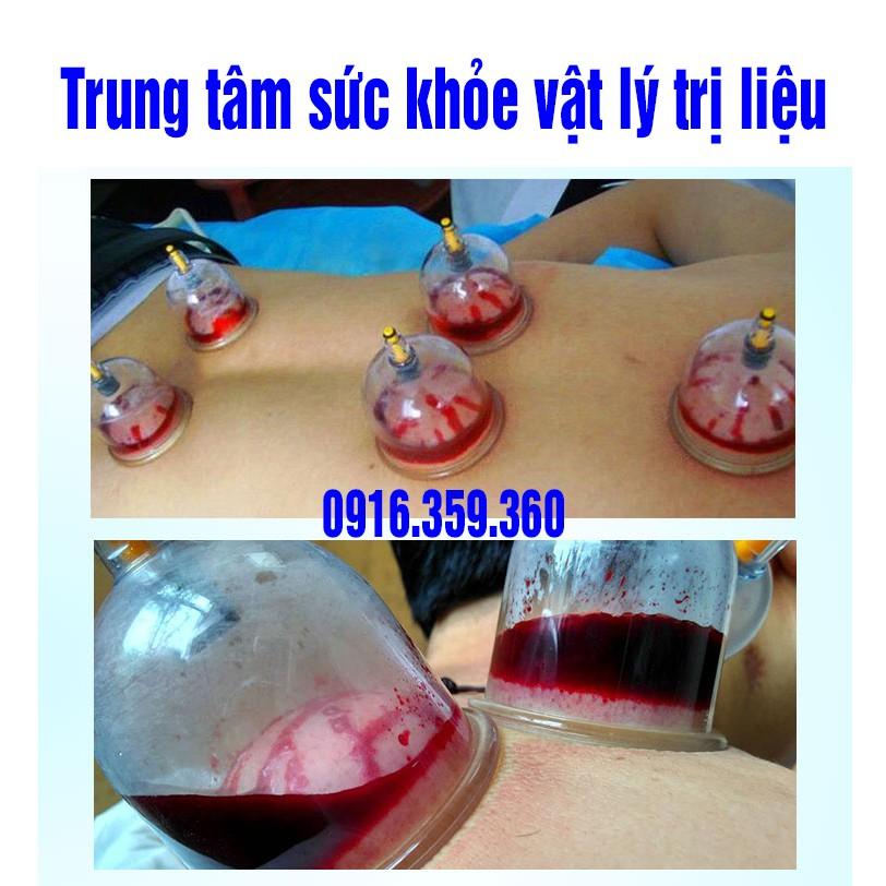 Bút chích máu giác hơi 4 đầu kim (km 200 kim)