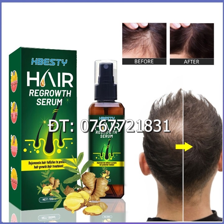 Serum dưỡng mọc tóc, giúp tóc mọc nhanh, nhiều và dày, sợi tóc đen bóng xuất xứ Nhật Bản – Mã số 1230