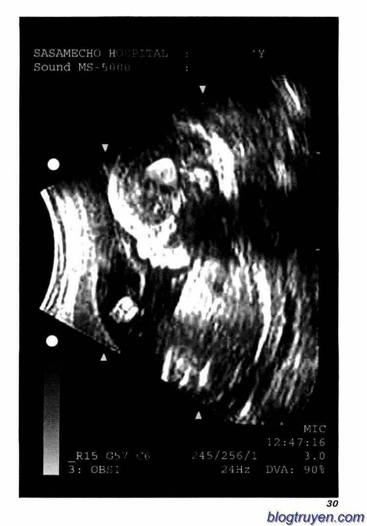 elfen lied chapter 72 29