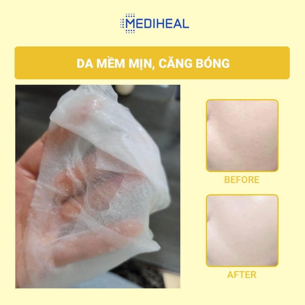 Mặt Nạ Mediheal Vita Toning Essence Mask Dưỡng Trắng Da, Mờ Thâm Nám 20ml