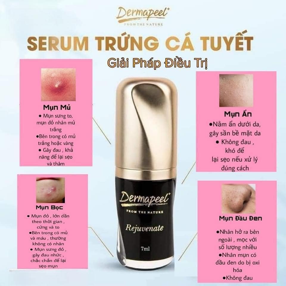 Combo 5 lọ Serum Trứng Cá Tuyết Dermapeel