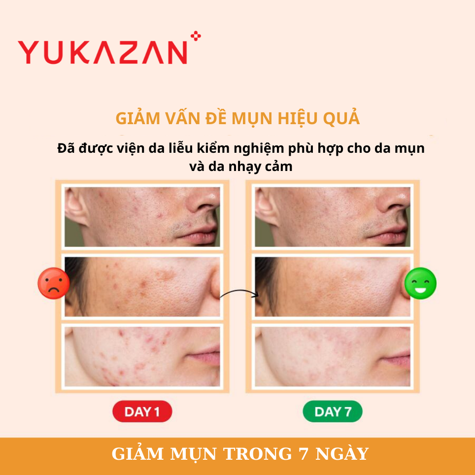 [QUÀ TẶNG] Kem Giảm Mụn Yukazan Derma Refining Cream - 3ml