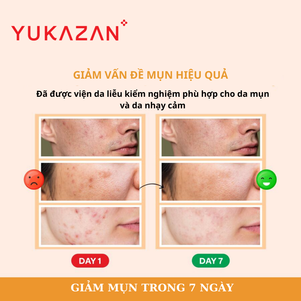 Kem Giảm Mụn, Giảm Viêm Yukazan Refining Cream 30ml - Công Thức Thảo Mộc Japan Murasaki