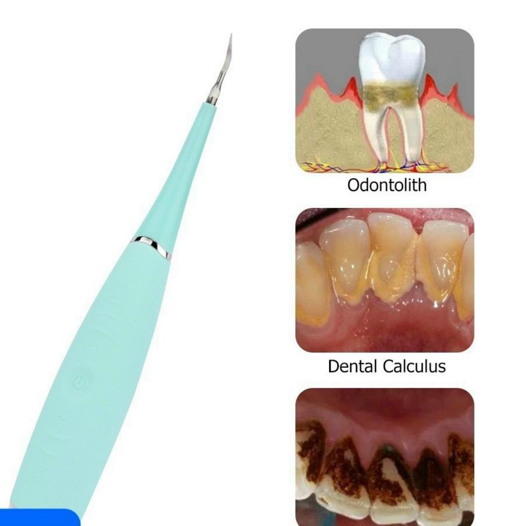 Máy Cạo Vôi Răng - Dụng Cụ Lấy Vôi Răng Đơn Giản Tại Nhà