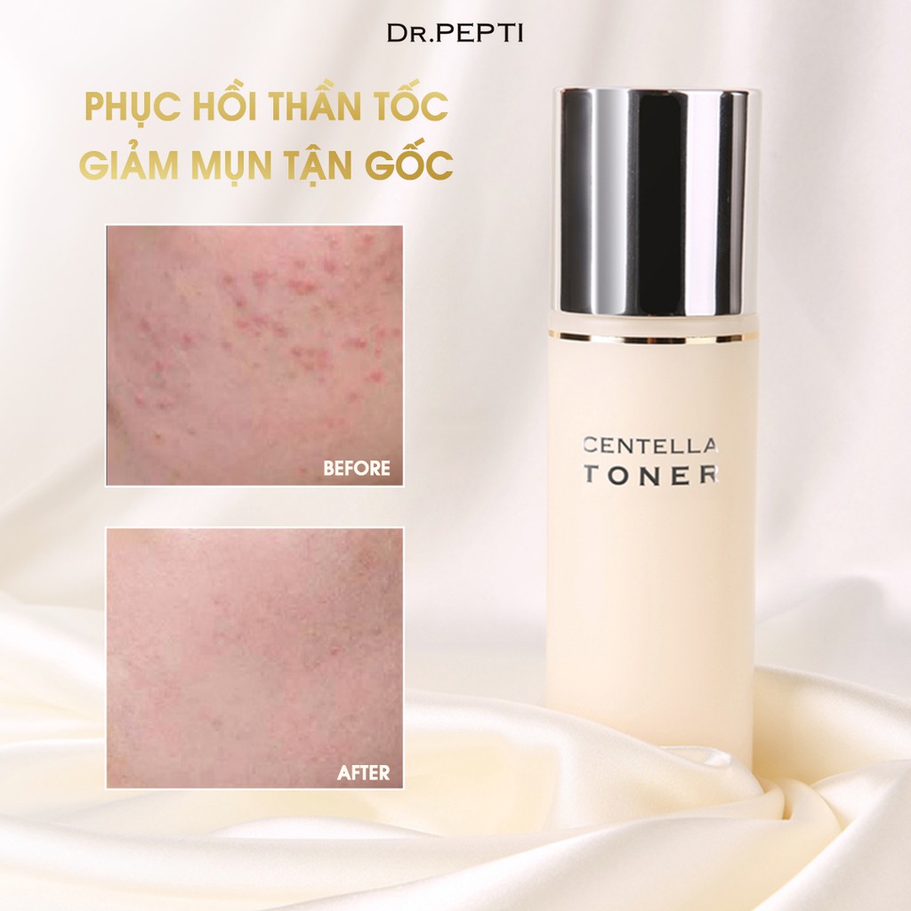 Nước Hoa Hồng Dr.Pepti+ Dưỡng Da Căng Bóng Centella Toner
