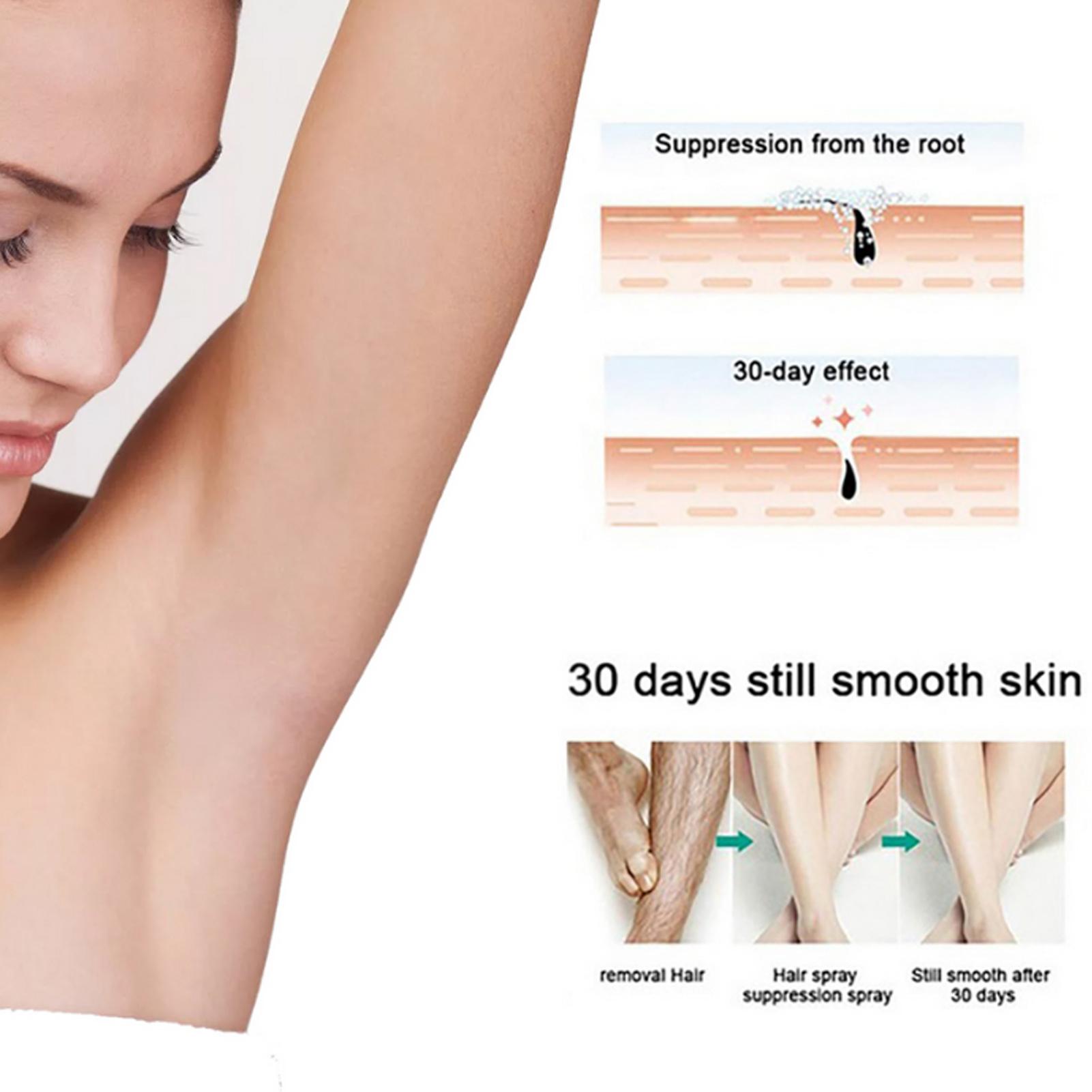 EELHOE 30ml Hair Removal Spray for Men Painless Hair Removal Spray Armpit Gentle Hair Remover Refreshing Quick Hair Removal Cream