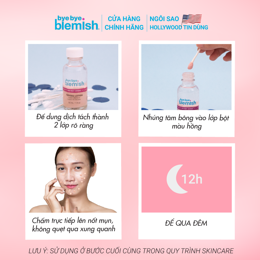 Chấm Mụn Giảm Mụn Nhanh Sau 1 Đêm Dành Cho Mụn Trắng, Sưng Đỏ Bye Bye Blemish Original Drying Lotion 30ml