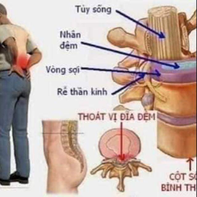 Tinh dầu xoa bóp 1 hộp