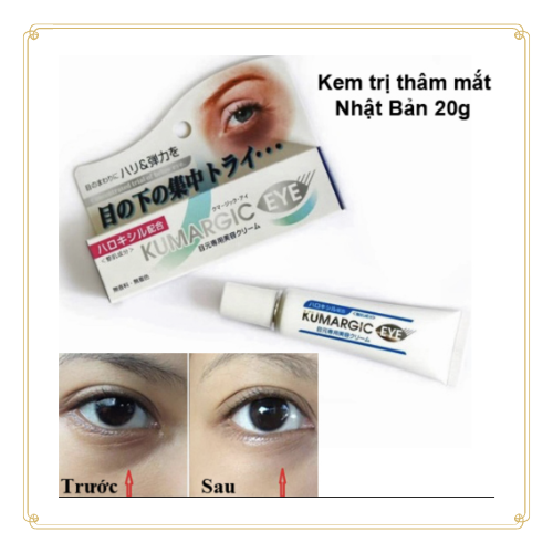 Kem mắt Kumargic Eye 20g hàng chuẩn Nhật Bản.