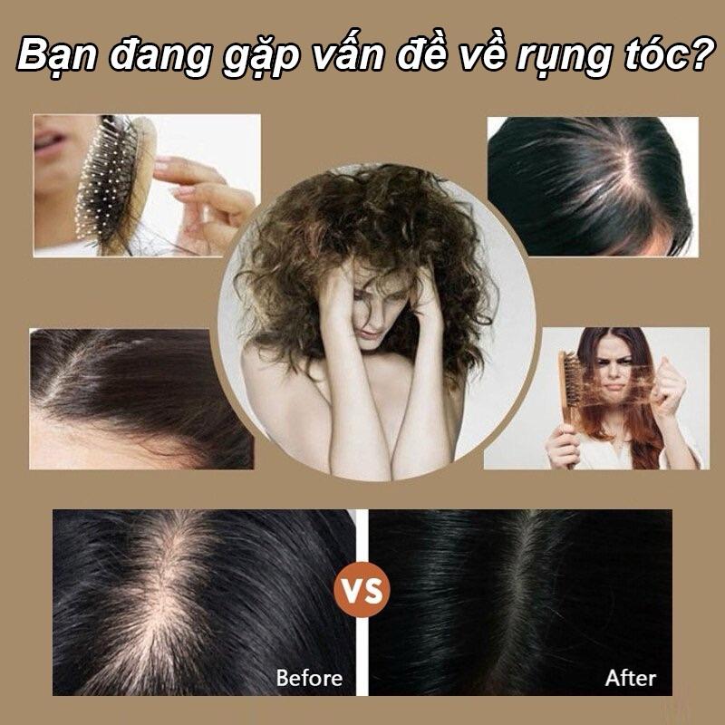 Tinh chất mọc tóc, giảm rụng L'Oreal Serioxyl Aminexil Scalp Advanced Pháp/TBN