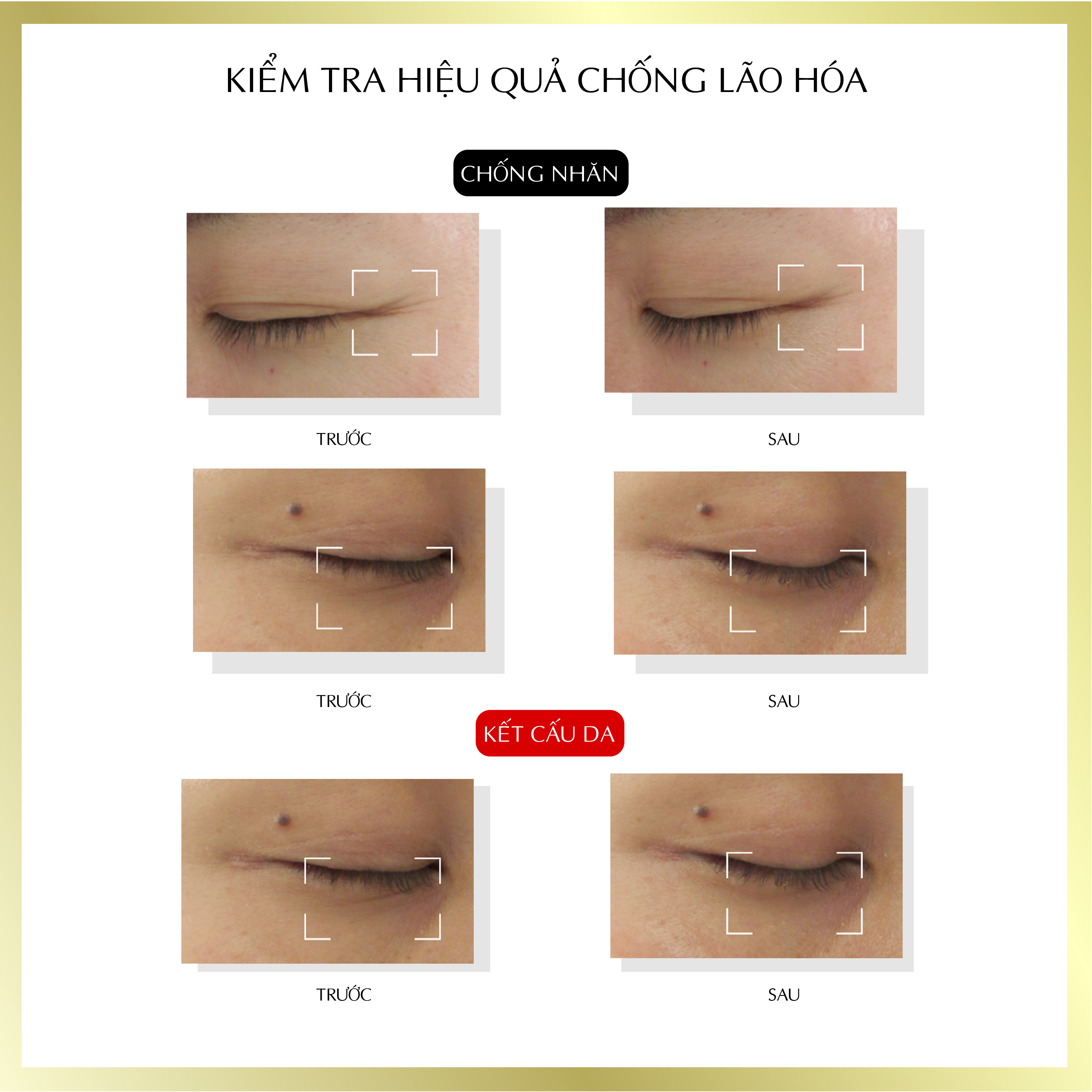 Tinh chất tế bào gốc dưỡng ẩm chuyên sâu Harinista Delivery Essence 30ml