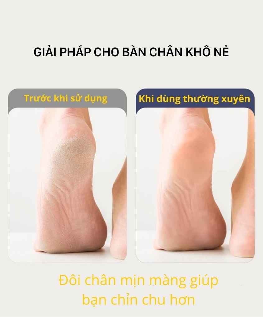 Máy chà da chết gót chân Enchen Rock làm mềm cục chai nứt nẻ gót chân, khuỷu tay - Tặng kèm 2 miếng chà