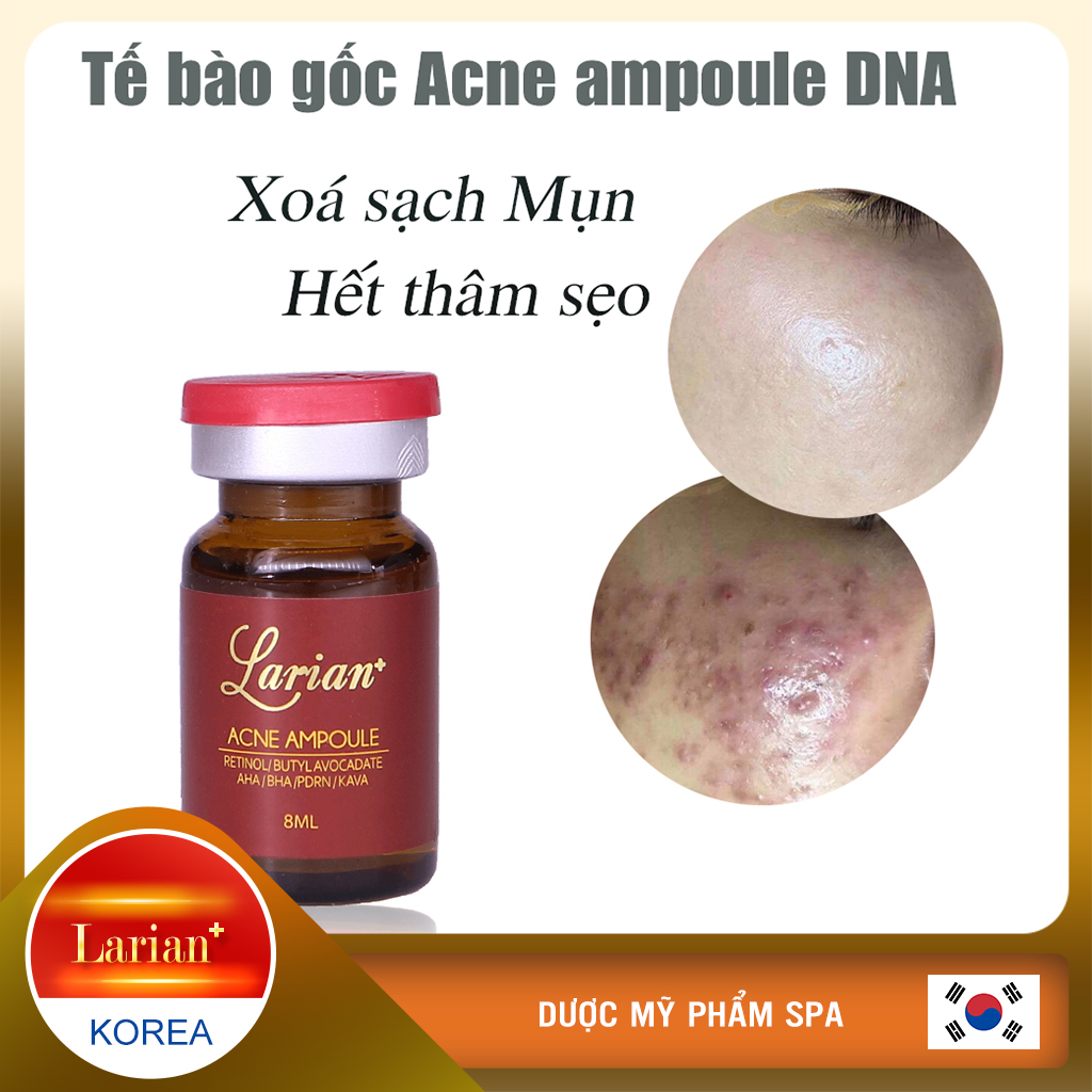 Tế bào gốc DNA cá hồi xóa sạch mụn,mờ thâm do mụn 8ml (LARIAN ACNE AMPOULE)