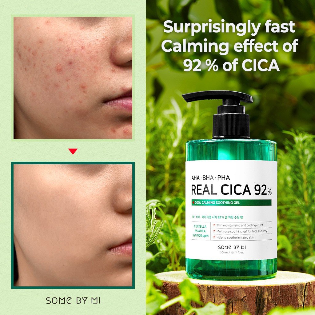 Gel dưỡng da làm dịu và giảm mụn Some By Mi AHA BHA PHA Real Cica 92% Cool Calming Soothing Gel 300ML + Tặng Kèm 1 Băng Đô Tai Mèo (Màu Ngẫu Nhiên)