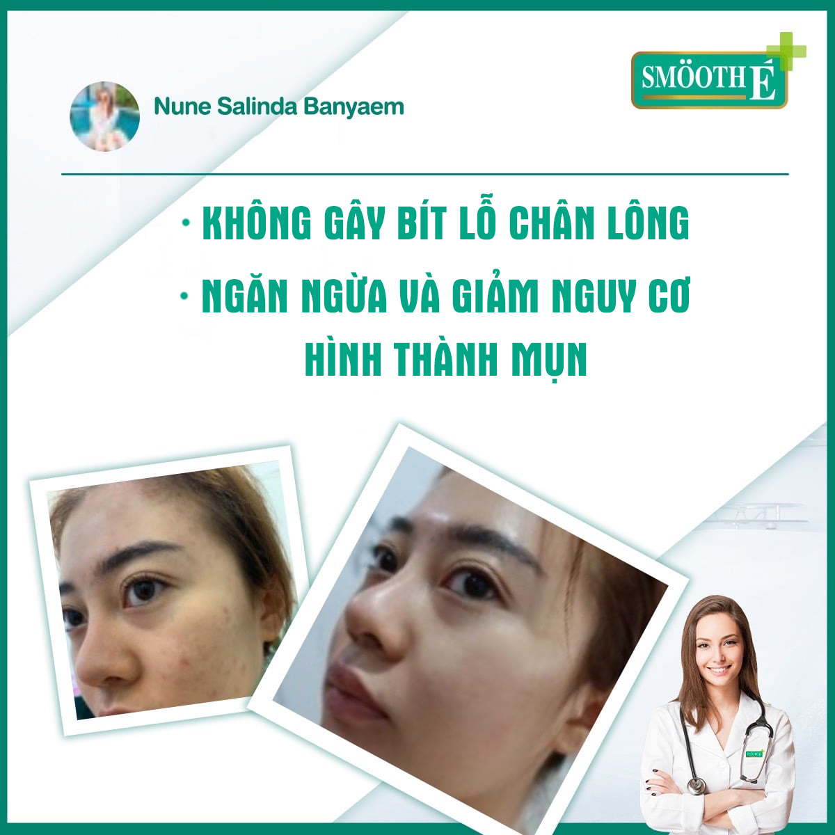 Sữa rửa mặt Smooth E Babyface Foam 3 in 1 (30ml)