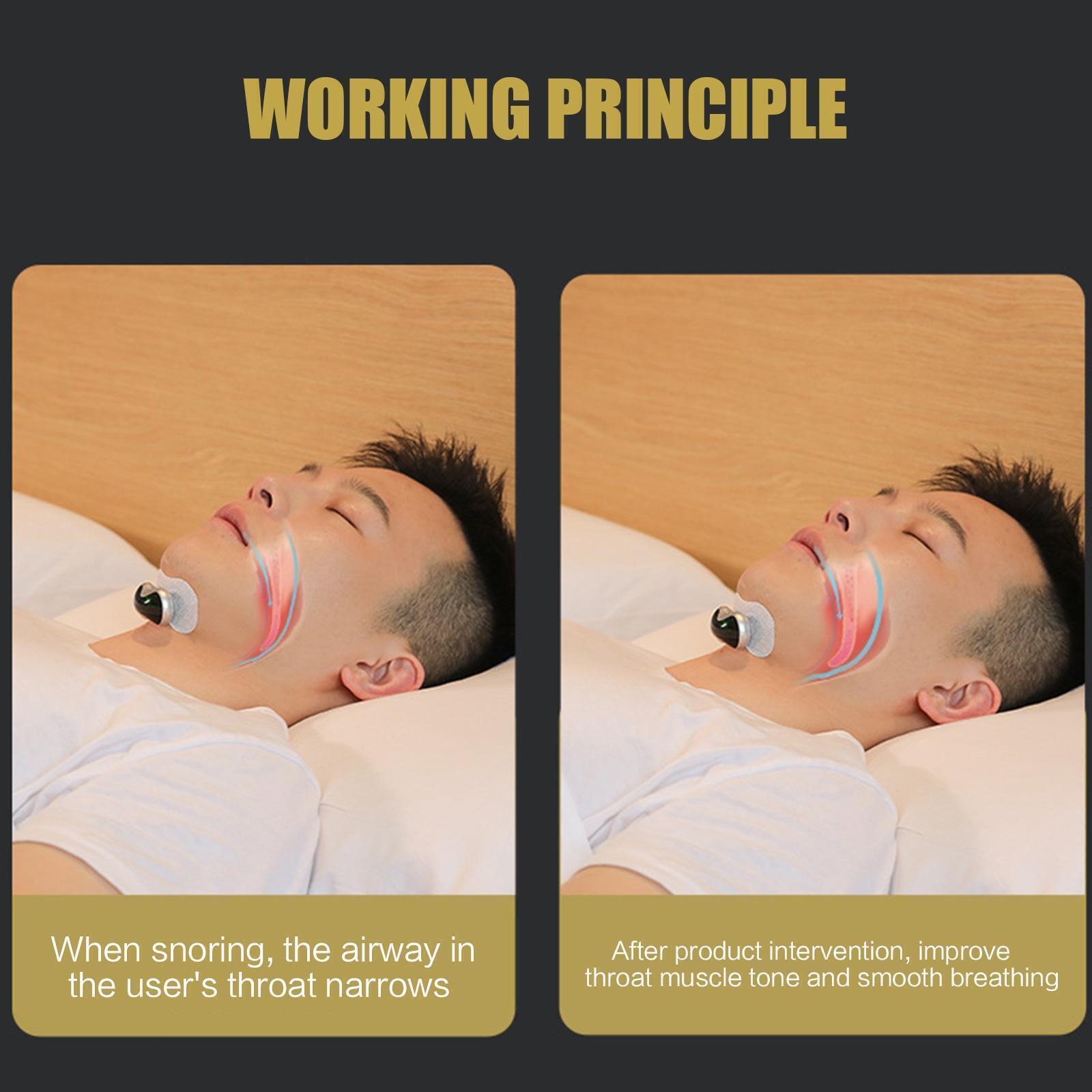 Thiết bị chống ngáy Smart Anti Snoring Device Portable Pulse Noise Reduction U5 Stimulator I4C7