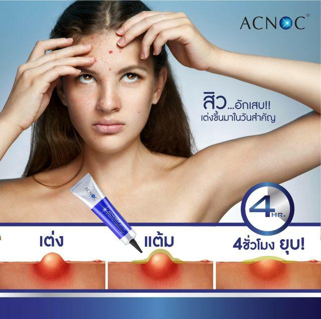 Gel Chấm Mụn ACNOC Thái Lan
