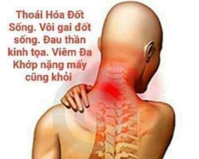 Tinh dầu xoa bóp 1 hộp