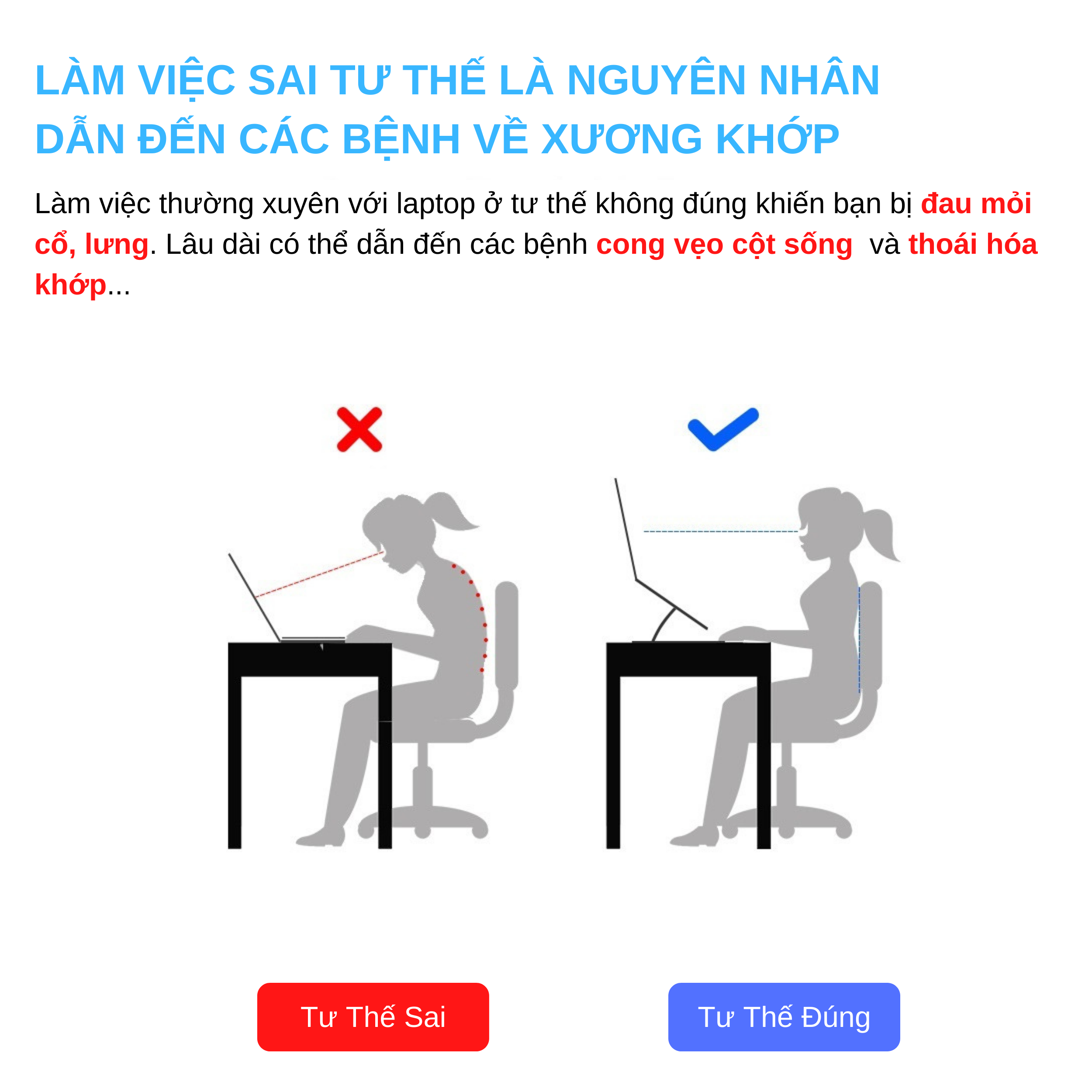 Hình ảnh Giá Đỡ Máy Tính, Laptop, iPad, Macbook Hợp Kim Nhôm Cao Cấp. Hỗ Trợ Tản Nhiệt Chống Mỏi Cổ, Vai, Gáy. Hàng Chính Hãng Tamayoko